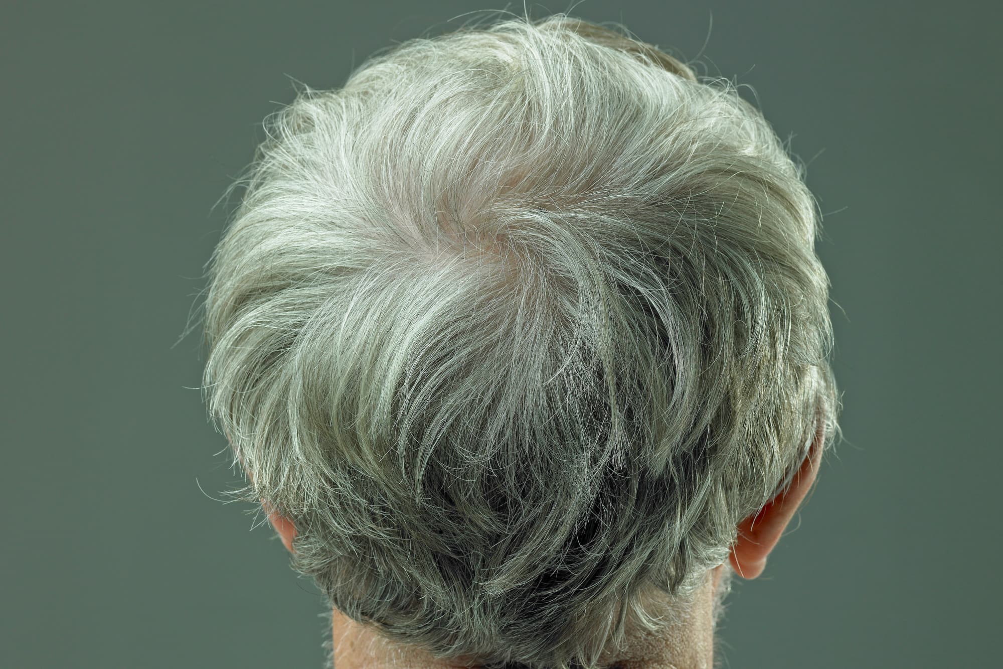 The Grey Hair Lie: Why Scientists 'Curing' Aging is Actually a Terrifying Economic Weapon