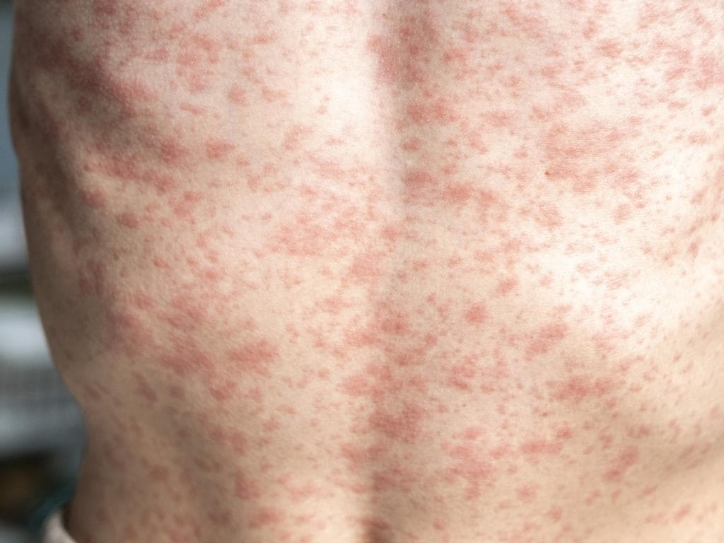 The Contagion Economy: Why This New Virus Warning Is Really About Control, Not Just Colds - Image 2