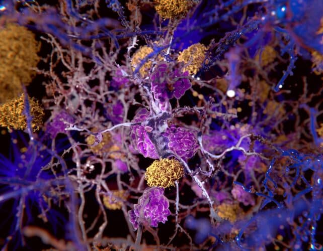 The Alzheimer's Lie: Why Your Gut Bacteria Are the Real Billion-Dollar Target - Image 2