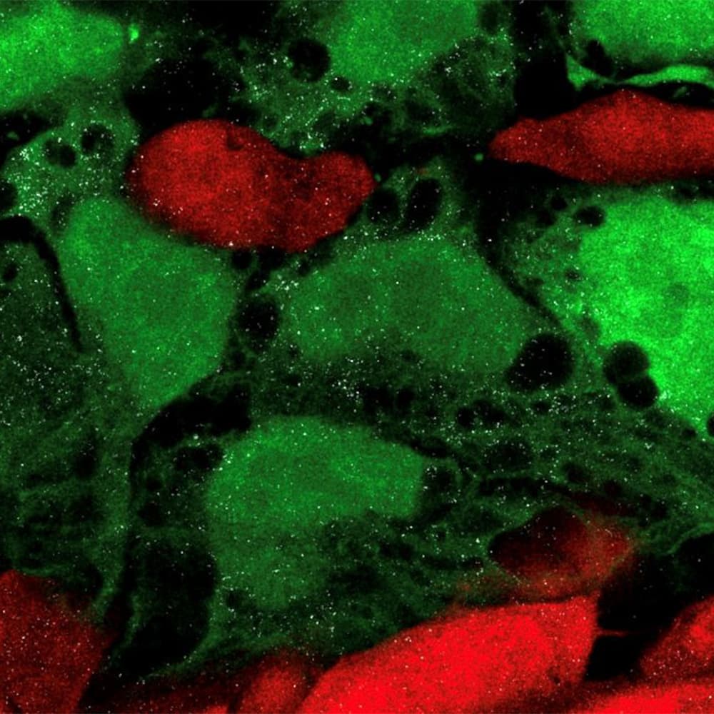 The Secret Cost of Growing Human Organs in Pigs: Why This Breakthrough Is Terrifying