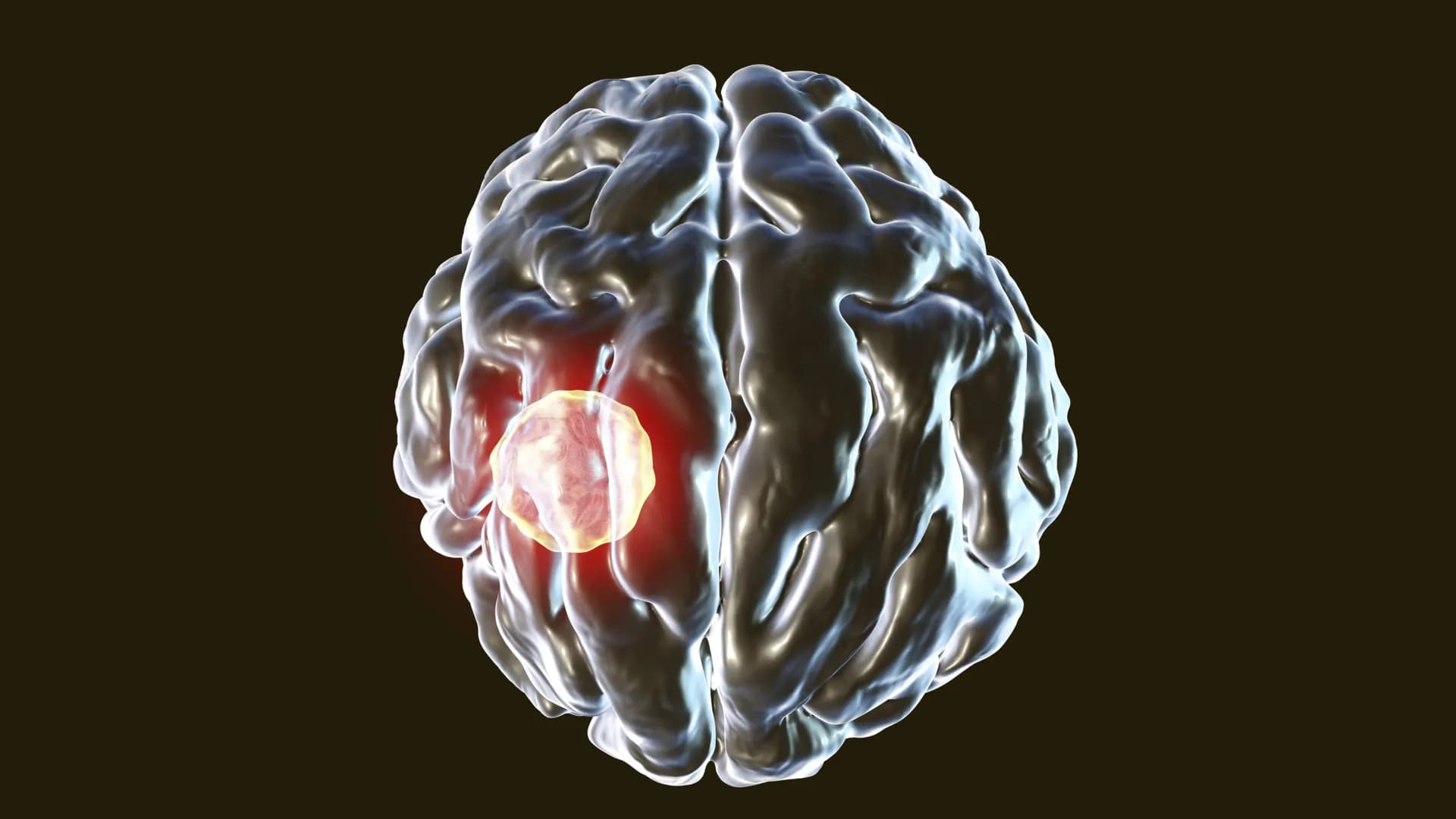 The Hidden Mind Control: Why Your 'Kill Switch' Against the Brain Parasite Is a Dangerous Illusion